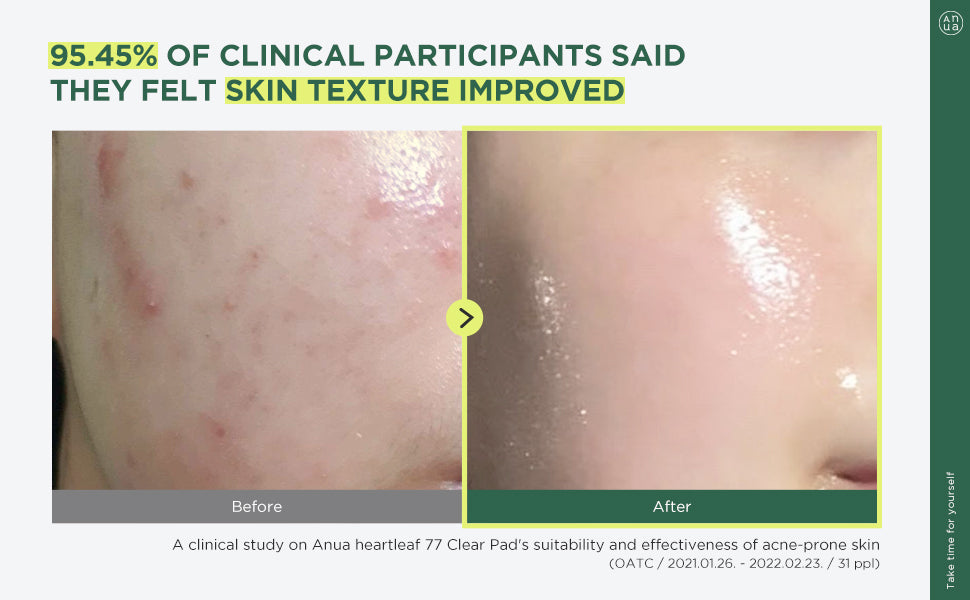 Anua Heartleaf 77% Toner Pad 70EA